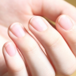爪のでこぼこの原因は何？！病気のサインかも。早期発見・早期治療が大切！