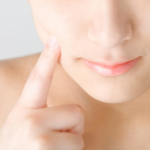 鼻の下のニキビの原因とは？大人ニキビに多い？改善方法